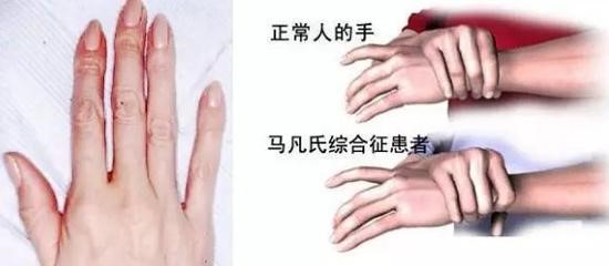 廈門眼科中心